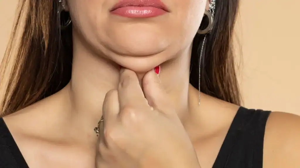 An image of a woman with double chin, sad, worried : Non Surgical Double Chin Removal Treatment in Sandwich, UK