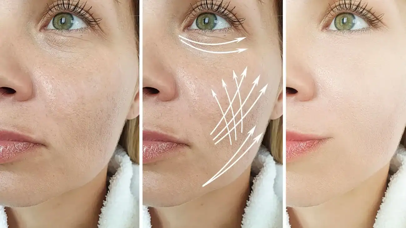 Can One Treatment Really Tackle More Than One Skin Concern Sandwich?