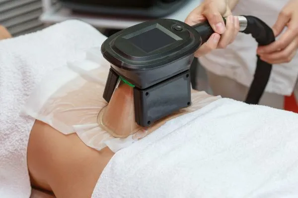 Image of person having fat freezing treatment to help weight gain Sandwich