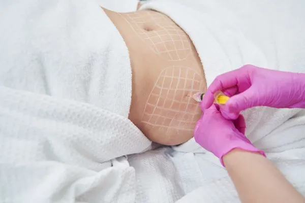 image of fat dissolving injections on love handles to help combat weight gain Sandwich