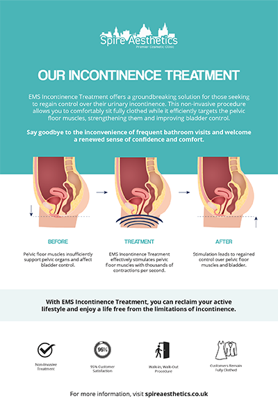 image of how urge incontinence Sandwich treatment works