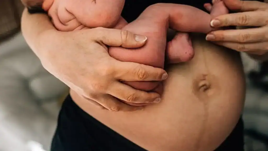 Why Is My Stomach Still Big After Pregnancy Sandwich?